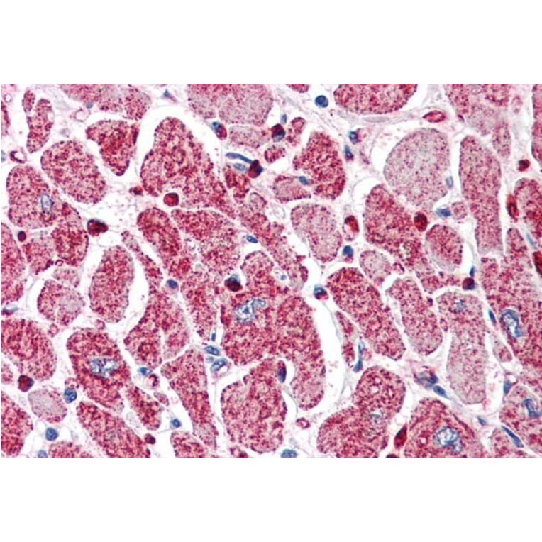 Immunohistochemistry - Anti-PI 3 Kinase Class 2A/Cpk Antibody (A84009) - Antibodies.com
