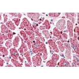 Immunohistochemistry - Anti-PI 3 Kinase Class 2A/Cpk Antibody (A84009) - Antibodies.com