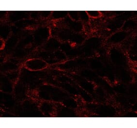 Immunofluorescence - Anti-Dispatched Antibody (A84010) - Antibodies.com