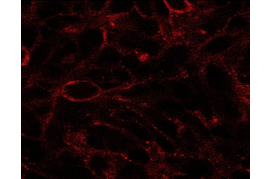 Immunofluorescence - Anti-Dispatched Antibody (A84010) - Antibodies.com