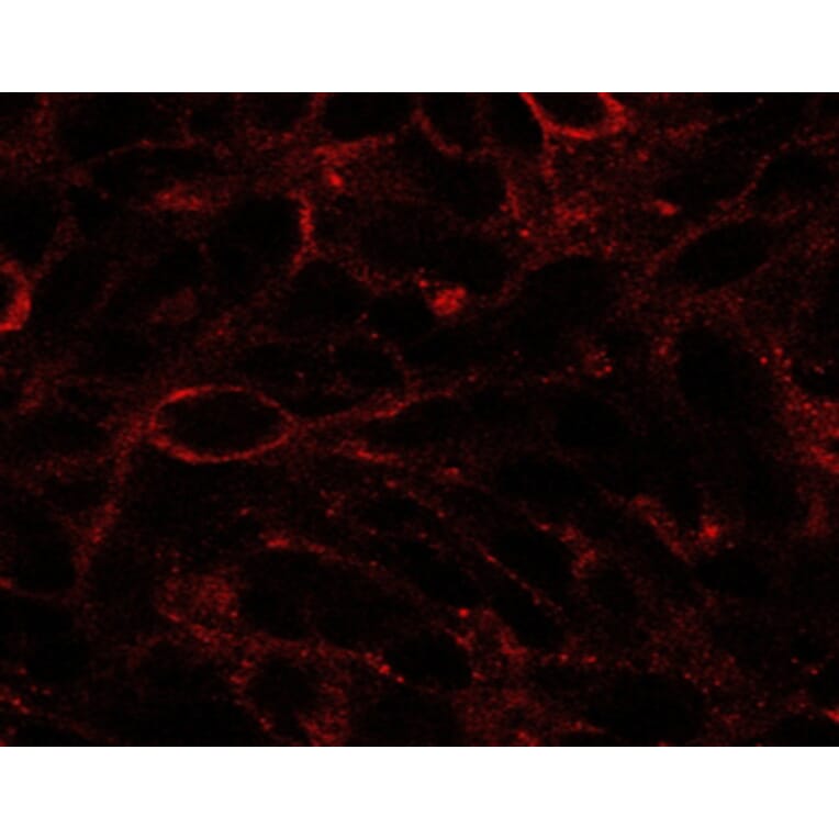 Immunofluorescence - Anti-Dispatched Antibody (A84010) - Antibodies.com