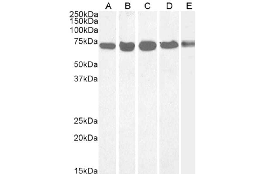 Western Blot - Anti-DDX5 Antibody (A84012) - Antibodies.com