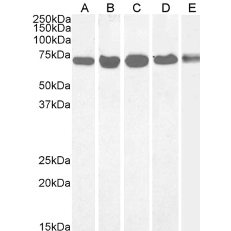 Western Blot - Anti-DDX5 Antibody (A84012) - Antibodies.com