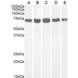 Western Blot - Anti-DDX5 Antibody (A84012) - Antibodies.com