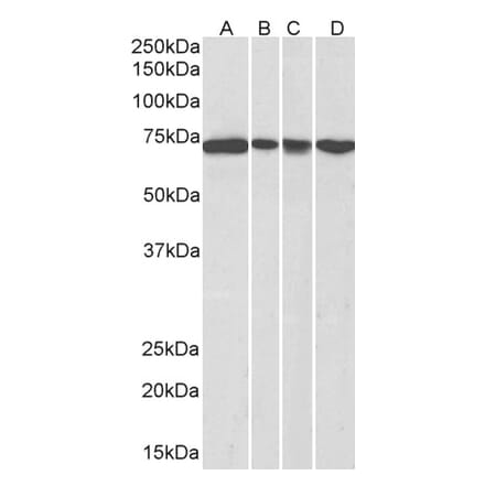 Western Blot - Anti-DDX5 Antibody (A84012) - Antibodies.com