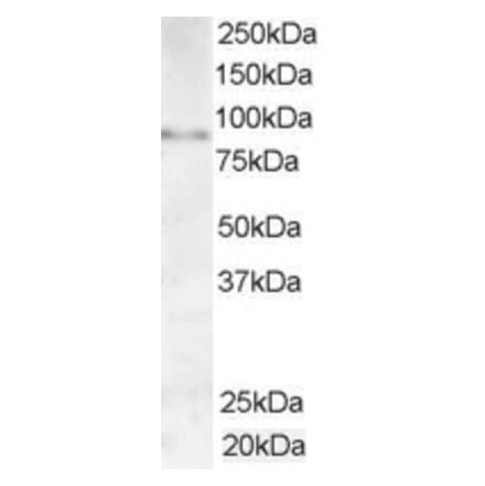 Western Blot - Anti-AKAP3 Antibody (A84013) - Antibodies.com