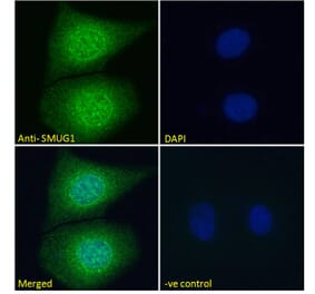 Immunofluorescence - Anti-SMUG1 Antibody (A84016) - Antibodies.com