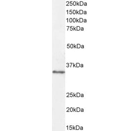 Western Blot - Anti-VDAC2 Antibody (A84017) - Antibodies.com