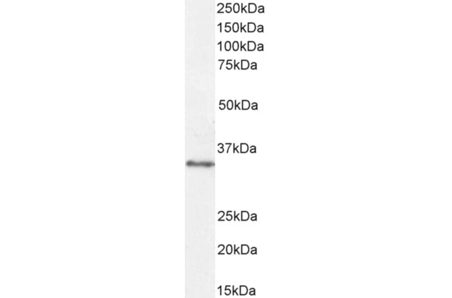 Western Blot - Anti-VDAC2 Antibody (A84017) - Antibodies.com