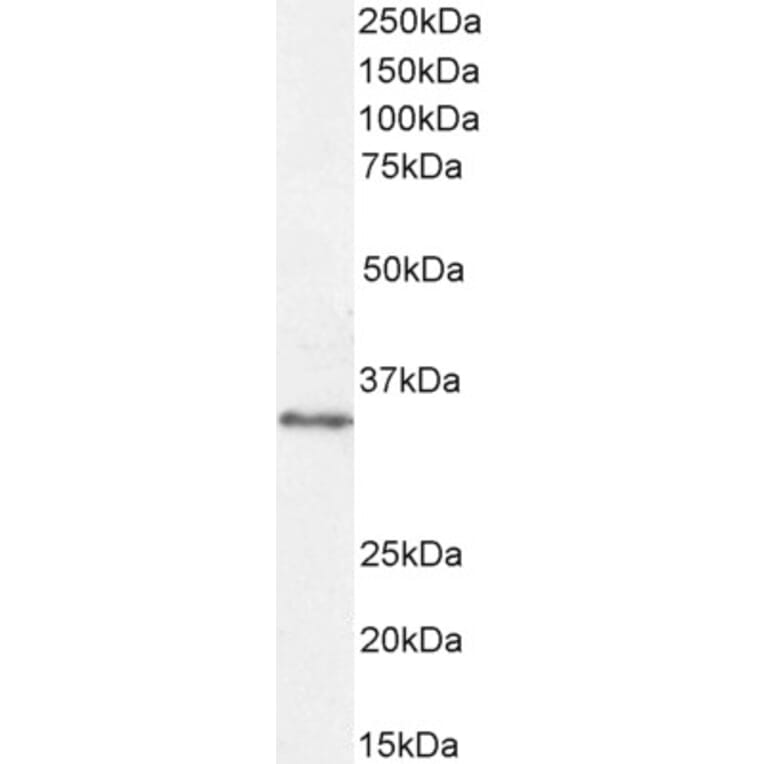 Western Blot - Anti-VDAC2 Antibody (A84017) - Antibodies.com