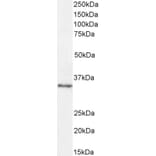 Western Blot - Anti-VDAC2 Antibody (A84017) - Antibodies.com