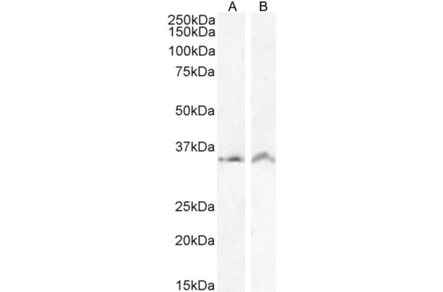 Western Blot - Anti-VDAC2 Antibody (A84017) - Antibodies.com