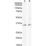 Western Blot - Anti-VDAC2 Antibody (A84017) - Antibodies.com