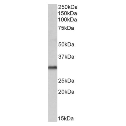Western Blot - Anti-VDAC2 Antibody (A84017) - Antibodies.com