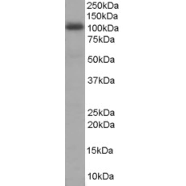 Western Blot - Anti-AKAP 95 Antibody (A84018) - Antibodies.com