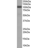 Western Blot - Anti-AKAP 95 Antibody (A84018) - Antibodies.com