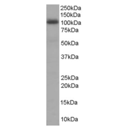Western Blot - Anti-AKAP8 Antibody (A84018) - Antibodies.com