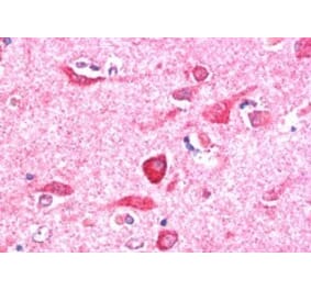 Immunohistochemistry - Anti-PITPnm 3 Antibody (A84020) - Antibodies.com