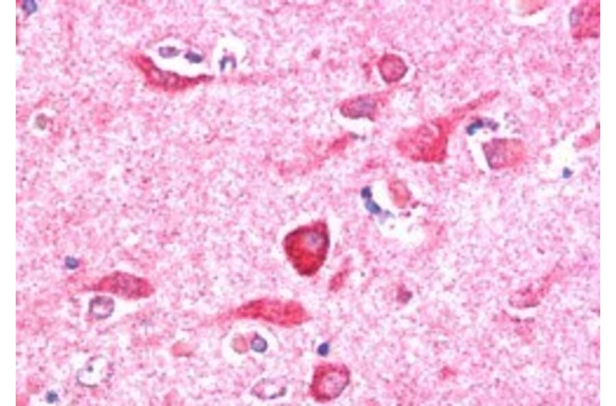 Immunohistochemistry - Anti-PITPnm 3 Antibody (A84020) - Antibodies.com