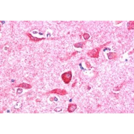 Immunohistochemistry - Anti-PITPnm 3 Antibody (A84020) - Antibodies.com