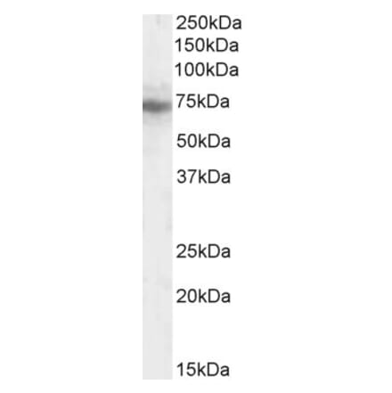 Western Blot - Anti-IFT74 Antibody (A84021) - Antibodies.com