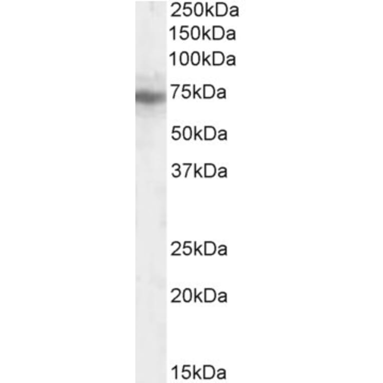 Western Blot - Anti-IFT74 Antibody (A84021) - Antibodies.com