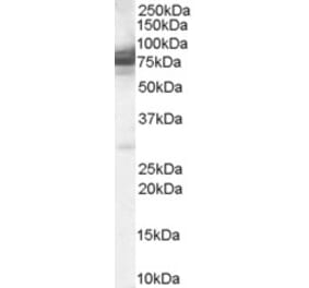 Western Blot - Anti-IFT74 Antibody (A84021)
