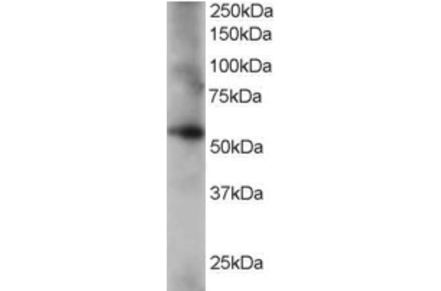 Western Blot - Anti-Coronin-1C Antibody (A84023) - Antibodies.com