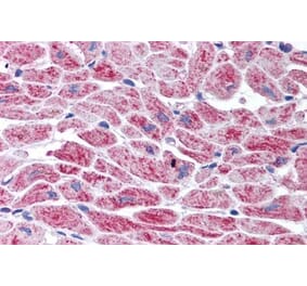 Immunohistochemistry - Anti-SNM1A Antibody (A84024) - Antibodies.com