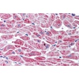 Immunohistochemistry - Anti-SNM1A Antibody (A84024) - Antibodies.com