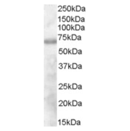 Western Blot - Anti-DEF6 Antibody (A84025) - Antibodies.com
