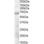 Western Blot - Anti-DEF6 Antibody (A84025) - Antibodies.com