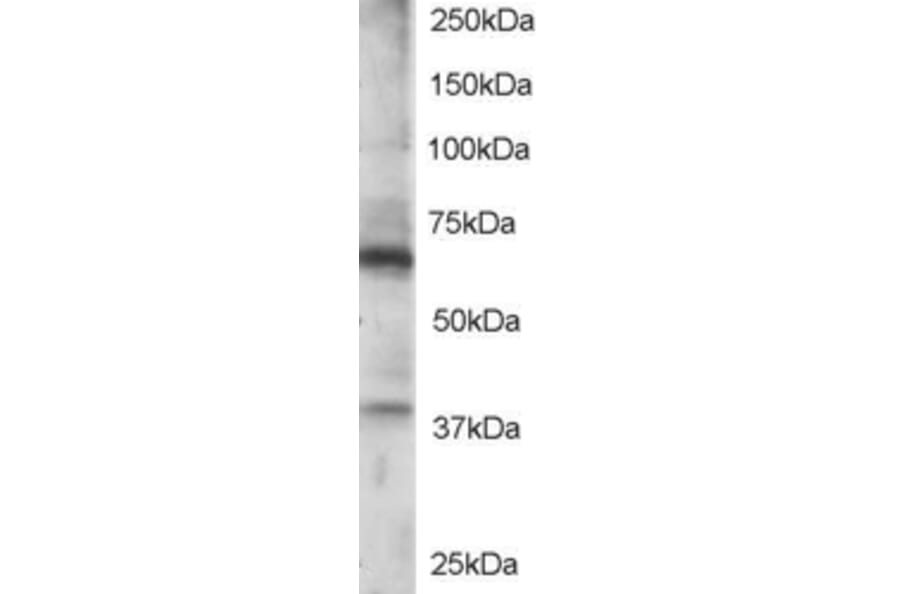 Western Blot - Anti-RGS14 Antibody (A84026) - Antibodies.com
