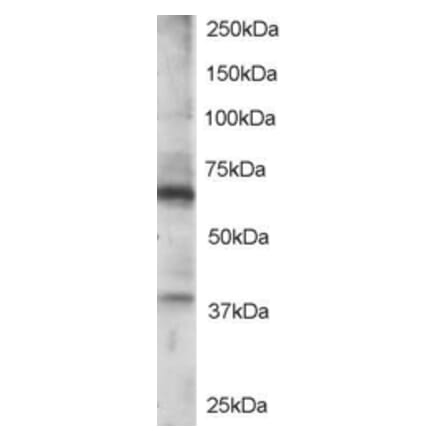 Western Blot - Anti-RGS14 Antibody (A84026) - Antibodies.com