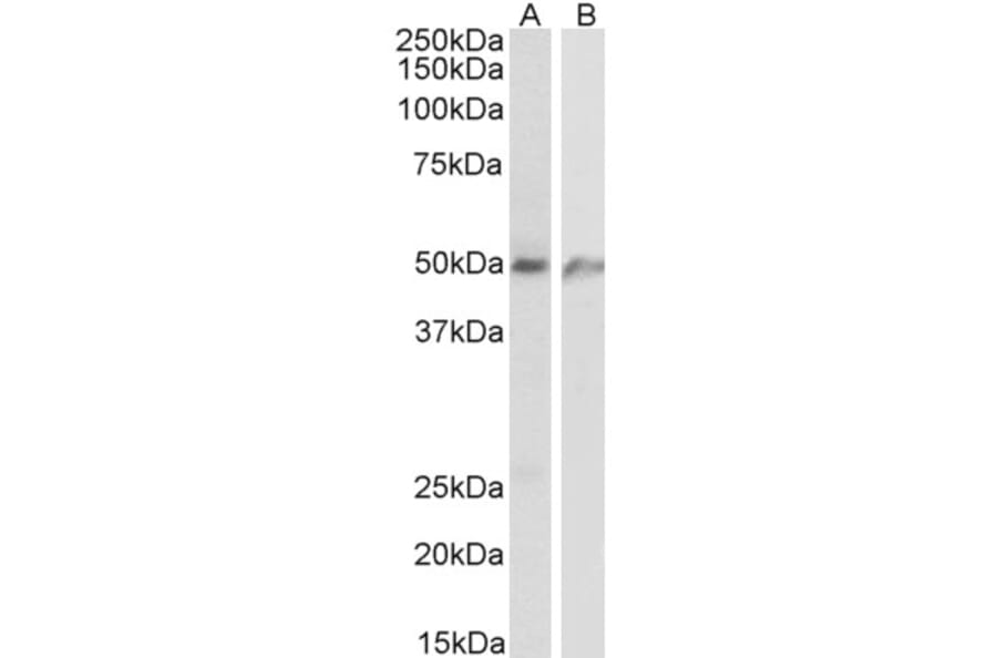 Western Blot - Anti-ECSM2 Antibody (A84028) - Antibodies.com