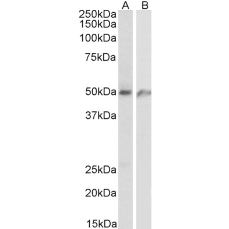 Western Blot - Anti-ECSM2 Antibody (A84028) - Antibodies.com