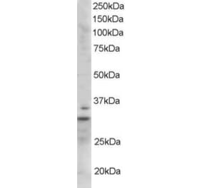 Western Blot - Anti-Lime1 Antibody (A84030) - Antibodies.com