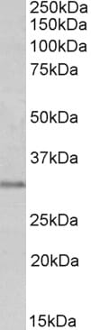 Anti-MSX1 Antibody (A84032) (0.3µg/ml) staining of Human Prostate lysate (35µg protein in RIPA buffer). Primary incubation was 1 hour. Detected by chemiluminescence.