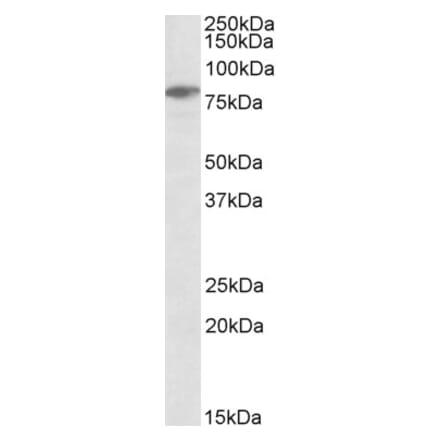 Western Blot - Anti-SLP76 Antibody (A84033) - Antibodies.com