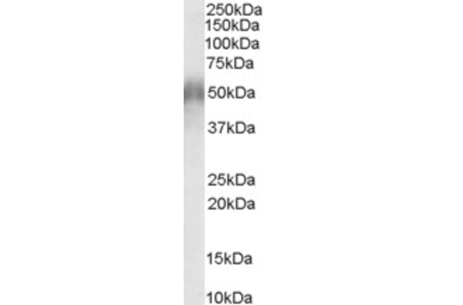 Western Blot - Anti-CD2BP2 Antibody (A84034) - Antibodies.com