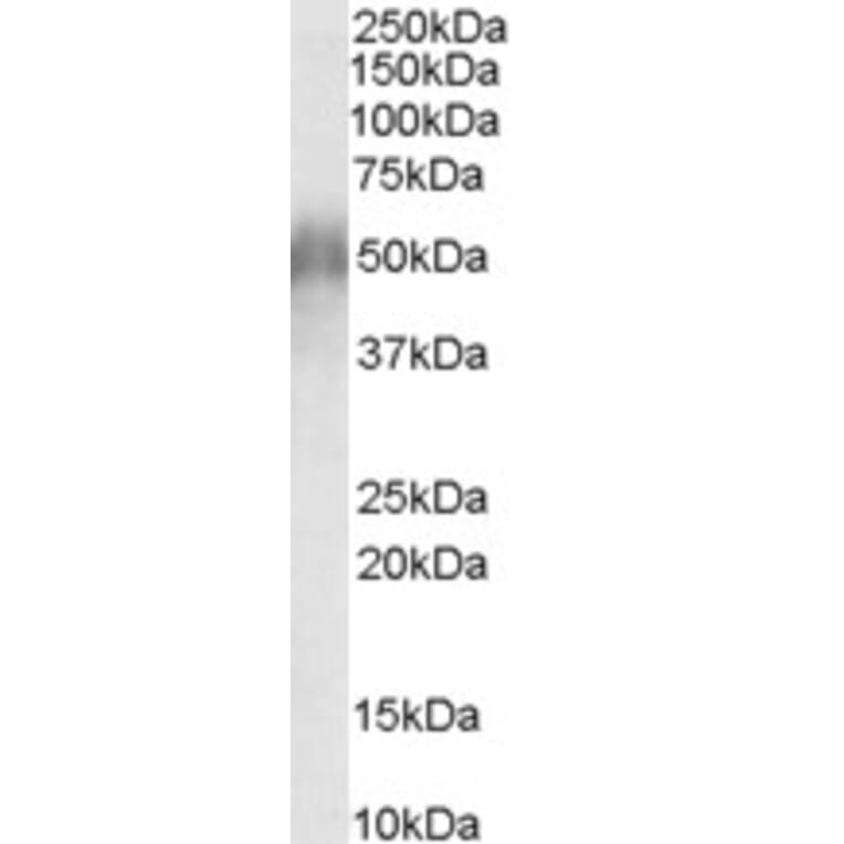 Western Blot - Anti-CD2BP2 Antibody (A84034) - Antibodies.com