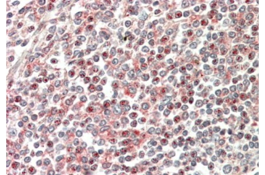 Immunohistochemistry - Anti-CD2BP2 Antibody (A84034) - Antibodies.com