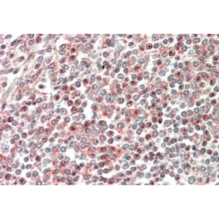 Immunohistochemistry - Anti-CD2BP2 Antibody (A84034) - Antibodies.com
