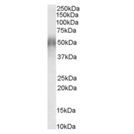 Western Blot - Anti-CD2BP2 Antibody (A84034) - Antibodies.com