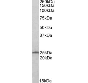 Western Blot - Anti-Ran Antibody (A84035) - Antibodies.com