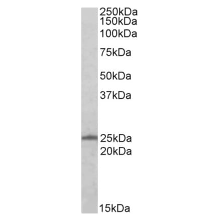 Western Blot - Anti-Ran Antibody (A84035) - Antibodies.com