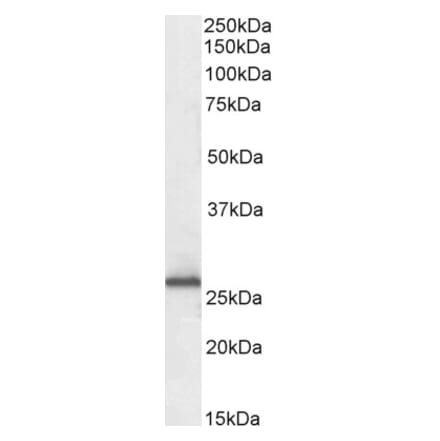 Western Blot - Anti-RanBP1 Antibody (A84036) - Antibodies.com