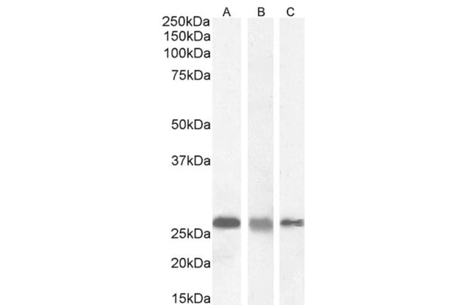 Western Blot - Anti-RanBP1 Antibody (A84036) - Antibodies.com