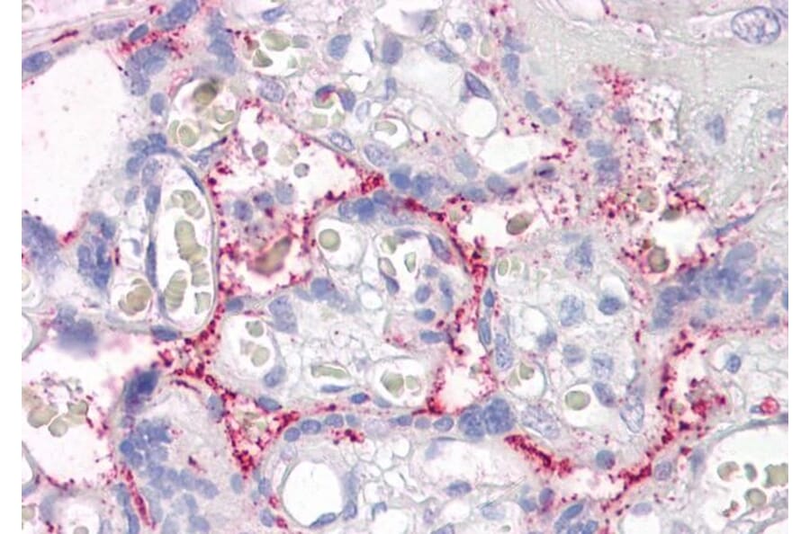 Immunohistochemistry - Anti-RAIN Antibody (A84037) - Antibodies.com
