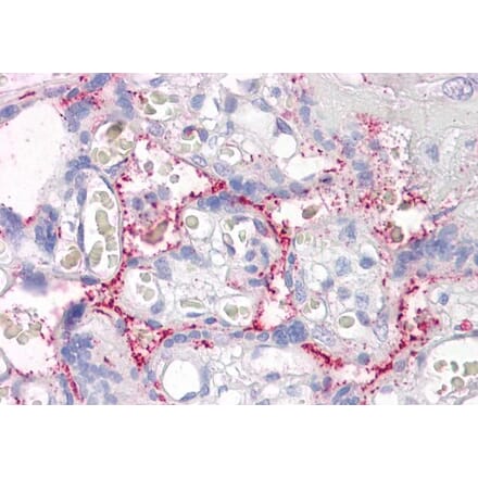 Immunohistochemistry - Anti-RAIN Antibody (A84037) - Antibodies.com